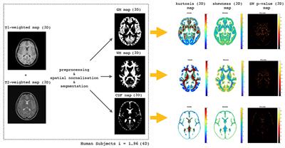 Non-parametric MRI Brain Atlas for the Polish Population